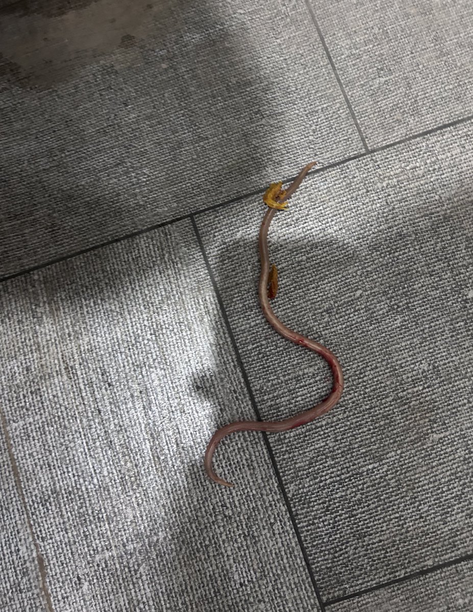 Lap_surgeon's tweet image. Today, a 32 year old patient came to me in the OPD with severe pain in anal region while defecation since last 7 days.

Today morning he passed this during defecation!

What is this??🤔
Any guesses #MedTwitter