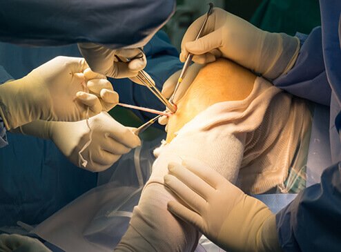 drBaxter77's tweet image. Good surgeons know when to operate.
Better surgeons know how to operate. 
Excellent surgeons know when not to operate.