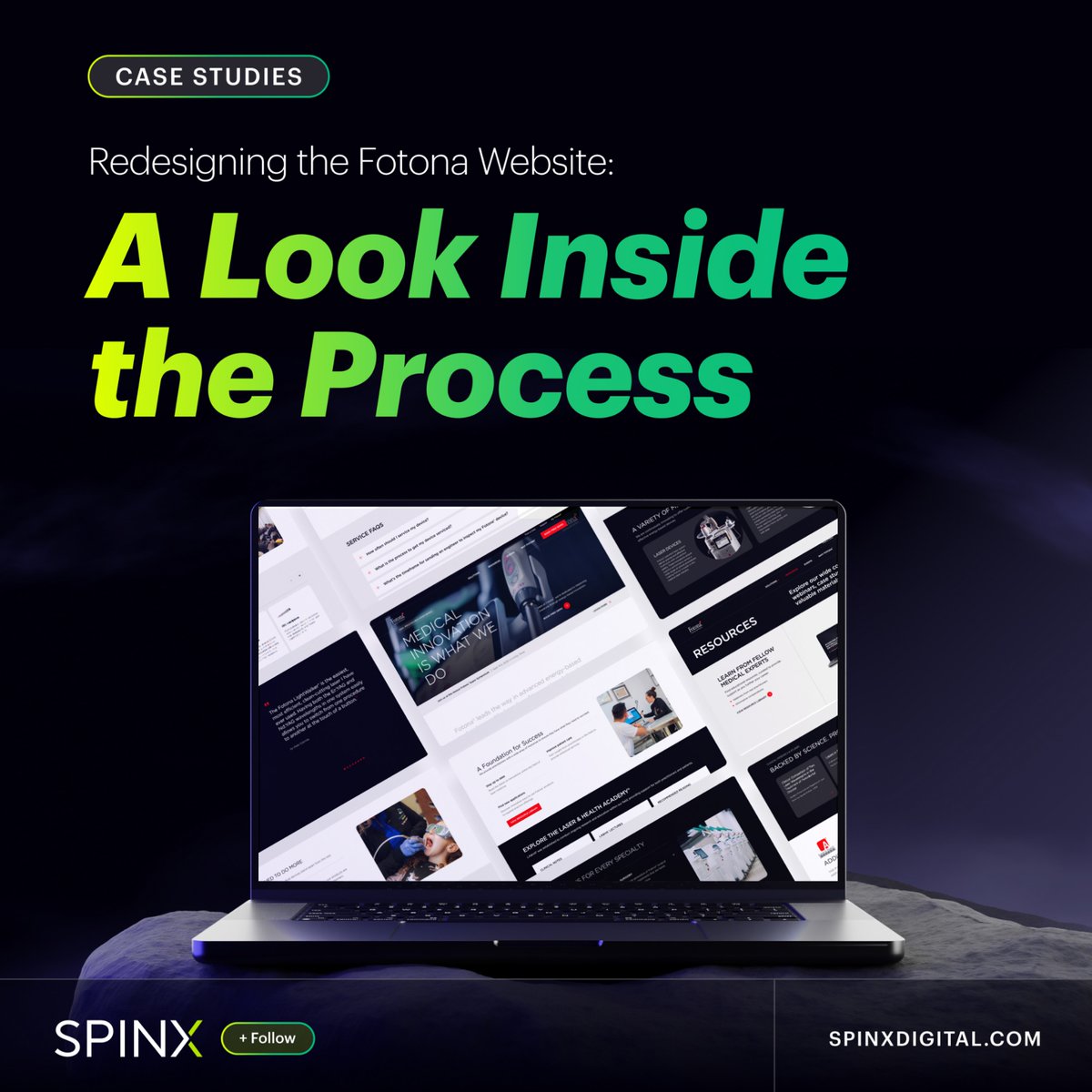 SPINXDigital's tweet image. Fotona needed a website that matched its laser tech innovation, so they partnered with SPINX Digital.

The result?
Faster, flexible Gutenberg design
360° product views
Smart forms &amp;amp; data relationships

See full case study at zurl.co/oYhM0

#WebsiteRedesign #SPINXDigital