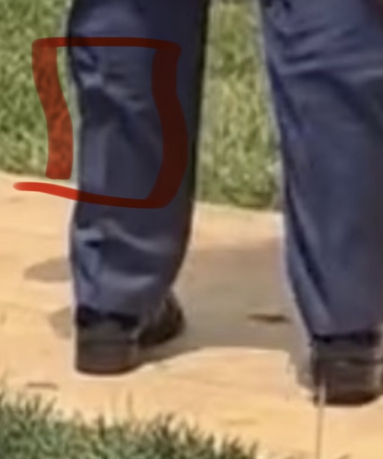 jacquie_rn's tweet photo. This 👇
He’s been wearing em since his NY trial. 
He’s in neurological decline .. bigly. 
And the docs are lying for him. https://t.co/y7ukLr17iN