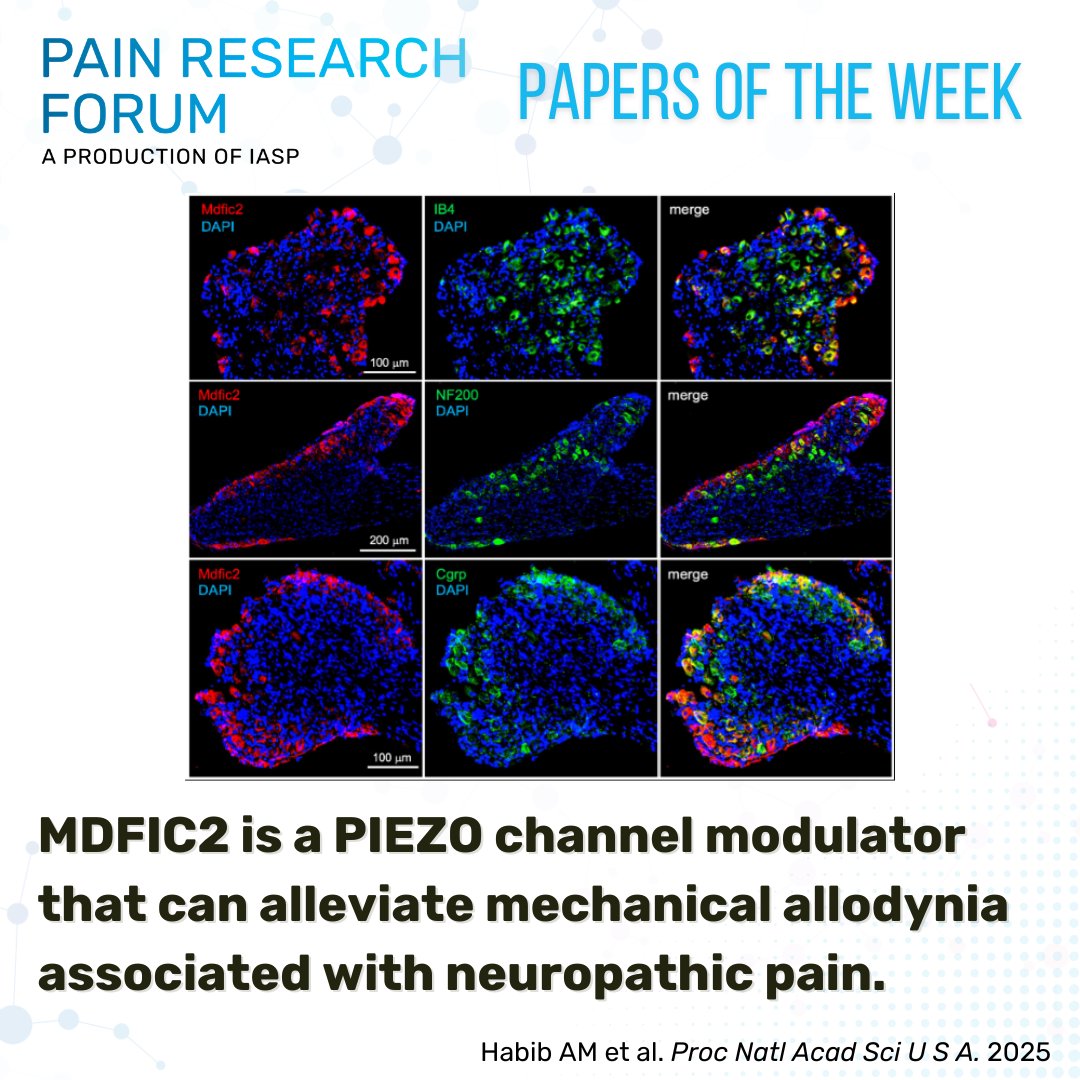 PainResForum's tweet image. Have you heard of MDFIC2, the newly identified sensory neuron-enriched modulator of PIEZO channels? Check out Habib et al. in @PNASNews, one of this week’s #EditorsPick papers chosen by @lab_seal bit.ly/4renN08 #PRF