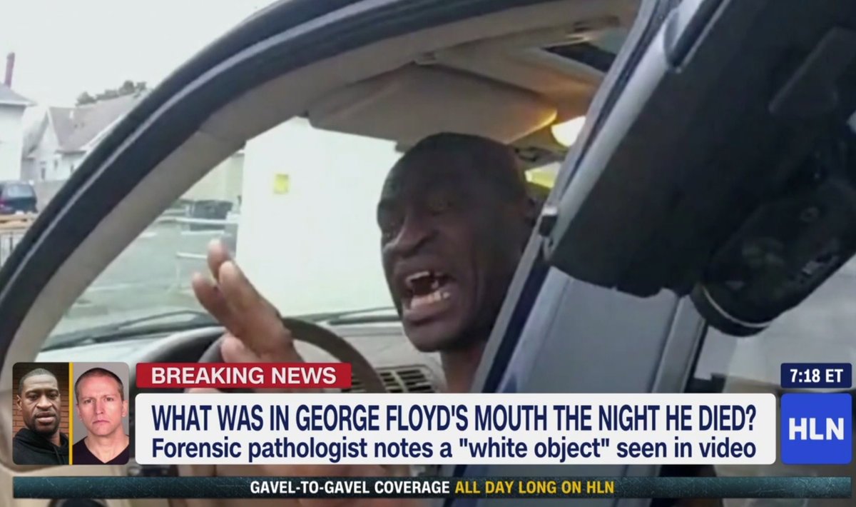 MeinGottNiles's tweet image. You can literally see a pill in his mouth in the bodycam footage.

They recovered multiple pills containing fentanyl and meth included one covered in George Floyd&apos;s saliva.

He tried to swallow them all and died for it.