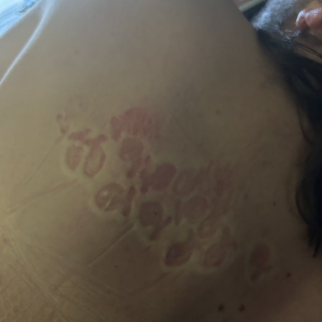 fellatiopleasee's tweet image. When I fell asleep on my goldfish