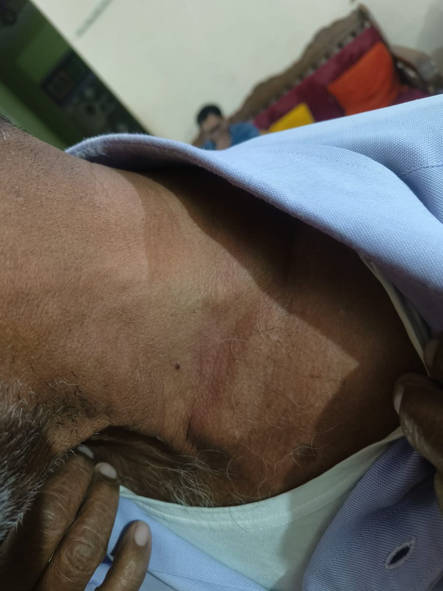 pawangupta68185's tweet photo. @PMOIndia 
@CMOfficeUP
@myogiadityanath
@adgzonekanpur
@dgpup
@jhansipolice
@sspjhansi 
घटना14/11/25 की है जिसमे वादी की शिकायत पर  पुलिस द्वारा आज दिनांक तक कोई करवाही नही की गई इसलिए वादी घटना की जानकारी यहां आपके संज्ञान में ला रहा है। https://t.co/HH2ptR8uDe