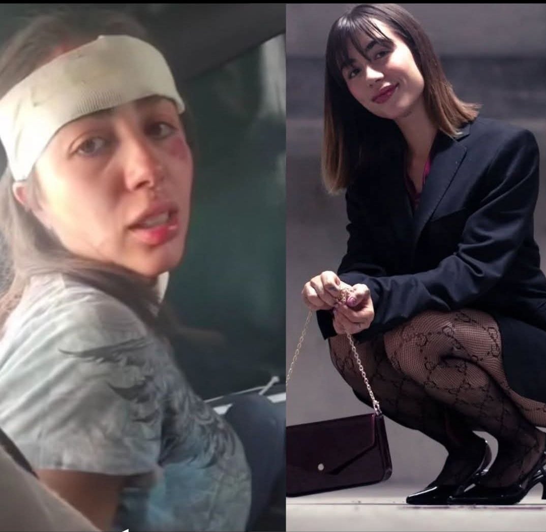 Un juez del bienestar desestimó los videos presentados por la joven Daniela Toussaint en su denuncia contra policías de la CDMX por abuso policial.

El argumento del juez para invalidar la evidencia fue que los videos podrían haber sido editados con inteligencia artificial (IA).