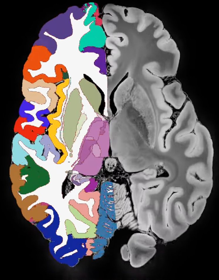 JuanEugenioIgl1's tweet image. We are hiring! Postdoc opportunity at our lab to work on several projects in human neuroimaging, with collaborators from Radiology, the Mass. Alzheimer’s  Research Center, MIT, UW, and/or the Allen Institute. Details at lemon.martinos.org/wp-content/upl…