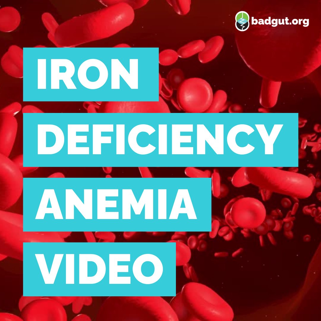 GISociety's tweet image. Today is #IronDeficiencyDay. This condition can happen for a number of reasons, and the symptoms of IDA are often vague, general, and present in different ways. badgut.org/ida-video-2024/

#video #irondeficient #anemia #canada #health