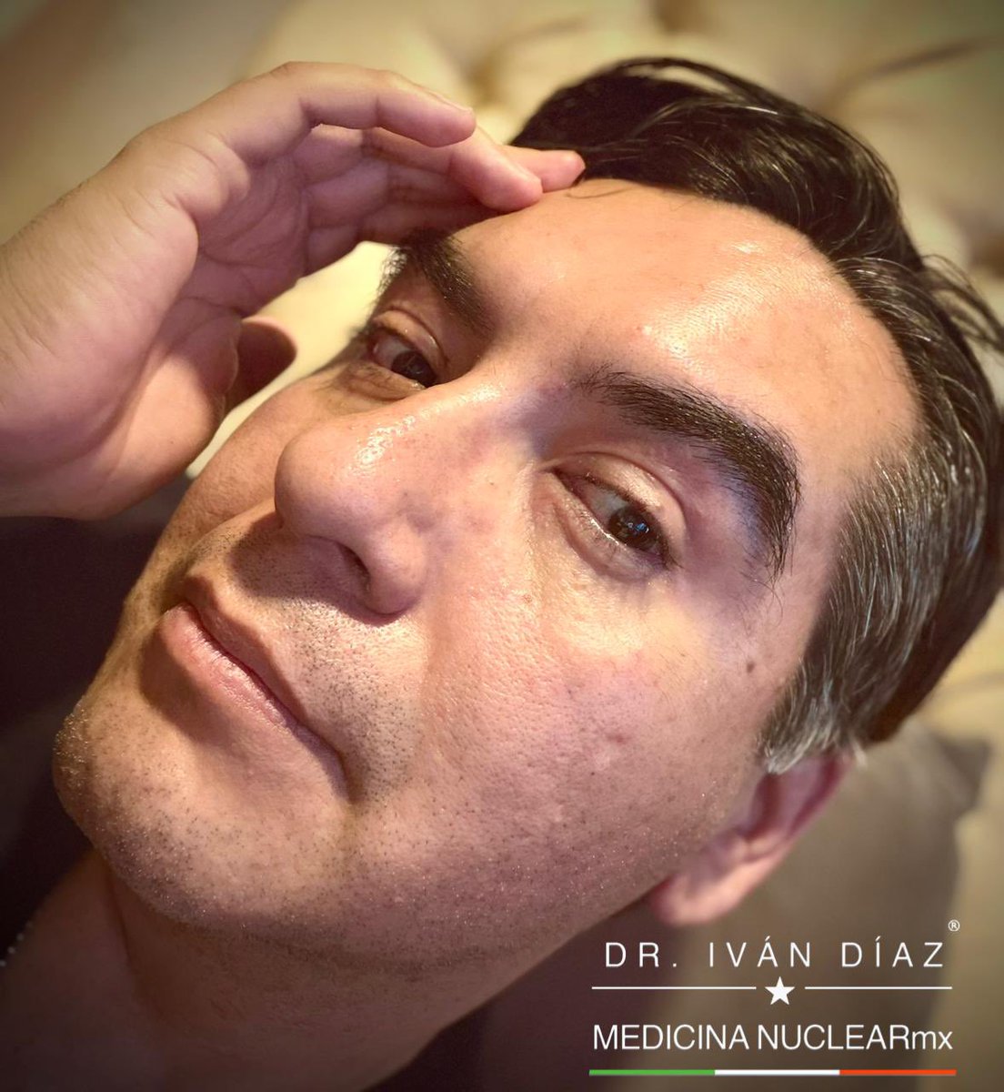 IvanDiazMeneses's tweet image. ⭐️Mexican Nucler Medicine Physicians 🇲🇽
🏆Leader and Founder of the Colectivo MedicinaNuclearMX! 💪🏼⚕️⚛️☢️
#nuclearmedicine #molecularimaging #theranostics 
The MedicinaNuclearMX collective are Mexican Nuclear Medicine Physicians promoting, expanding clinical use &amp;amp; doing…