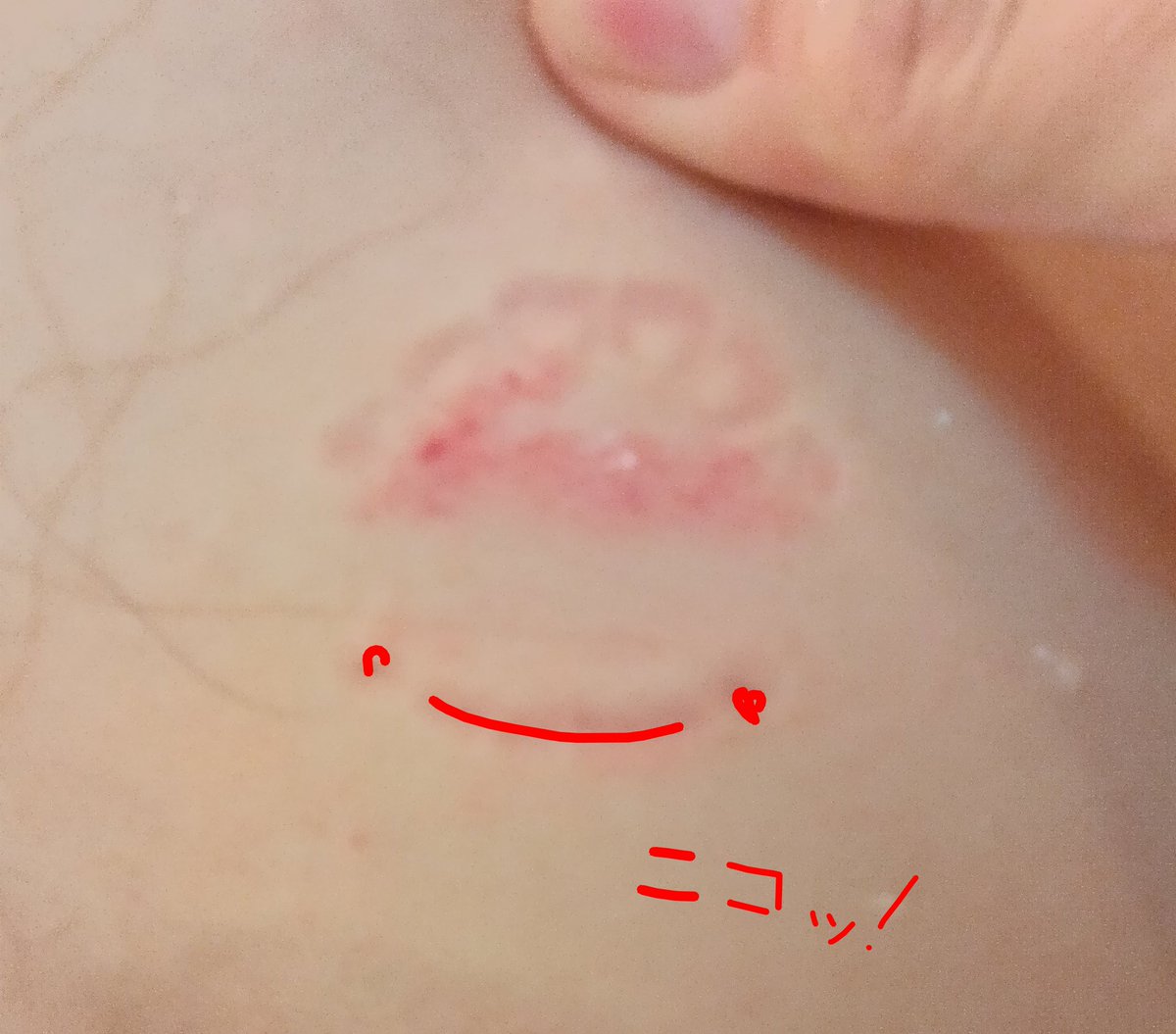 日焼けさん【ひとがたポケモン】 tweet media