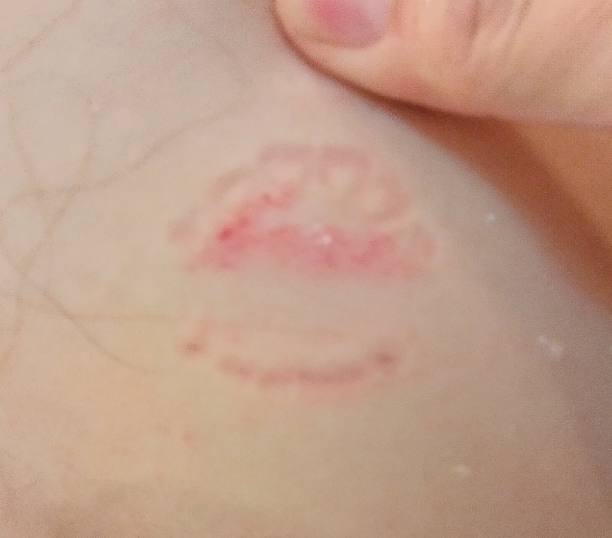 日焼けさん【ひとがたポケモン】 tweet media