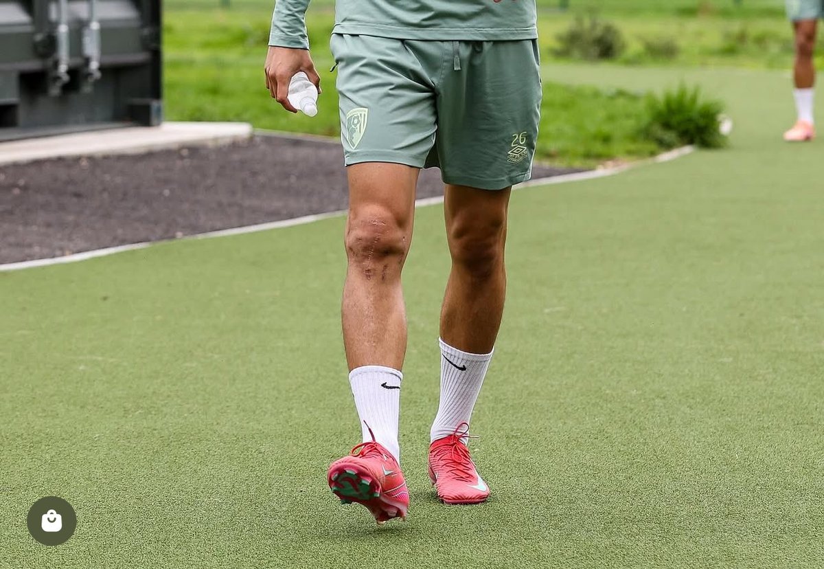 enes ünal'ın hayatı film olsa diye yazmıştım. o filmi nen çekiyor olsam afişine şu fotoyu koyardım. sağ dizine baksanıza bi her çiziğin altından sayfalarca hikaye çıkar. en sonunda da ya o çizikler olmasaydı neler yaşanırdı acaba diye düşünmekten kafayı yerdik