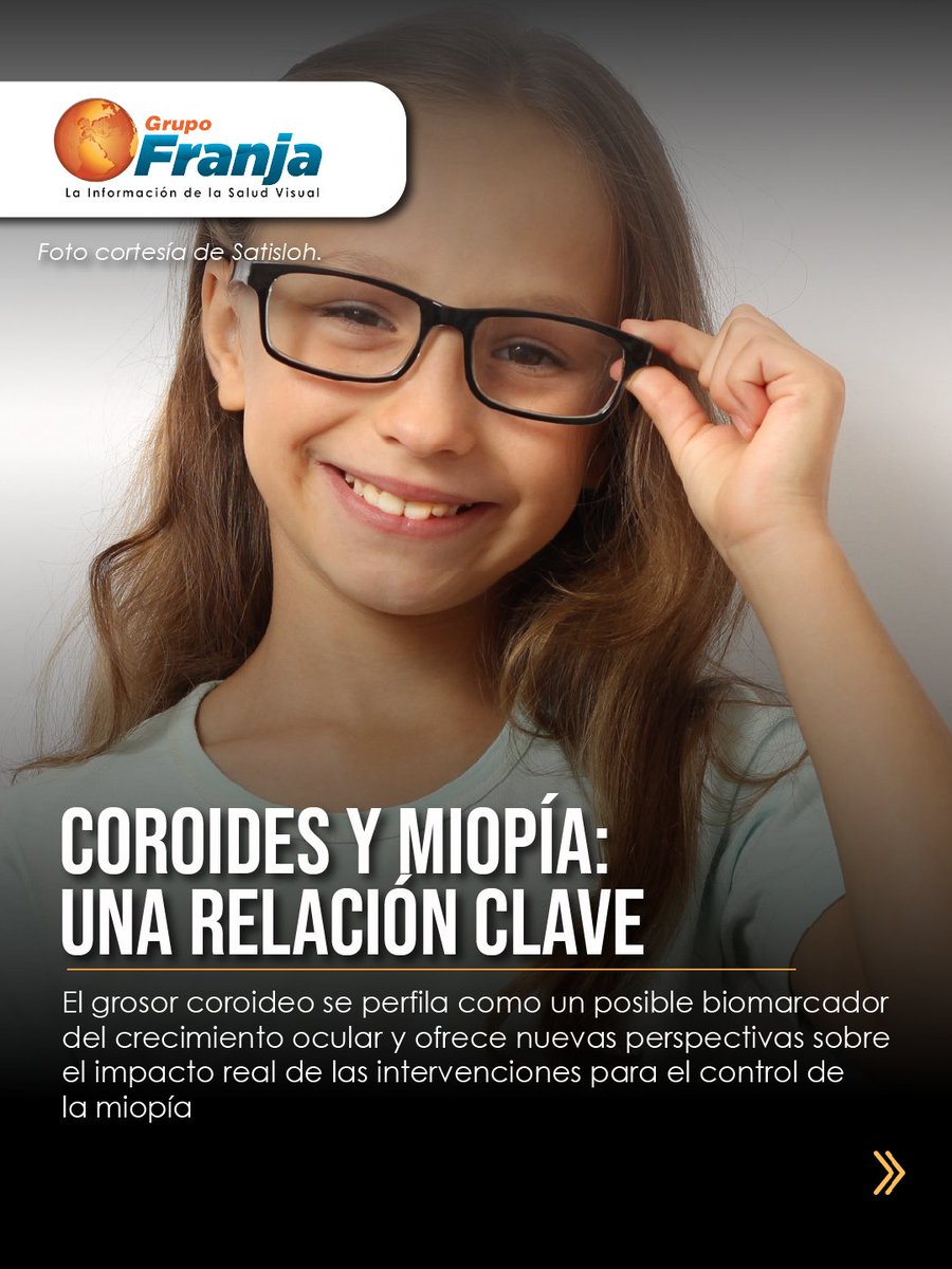 FranjaVisual's tweet image. La coroides podría ser un biomarcador del crecimiento ocular. Estudios recientes muestran que OK y OK + atropina se relacionan con aumentos en su espesor, un hallazgo clave en control de miopía.

👉🏾 f.mtr.cool/pverwixjdt 👈🏾

#NotasFranja #Lentes #SaludVisualConEstilo