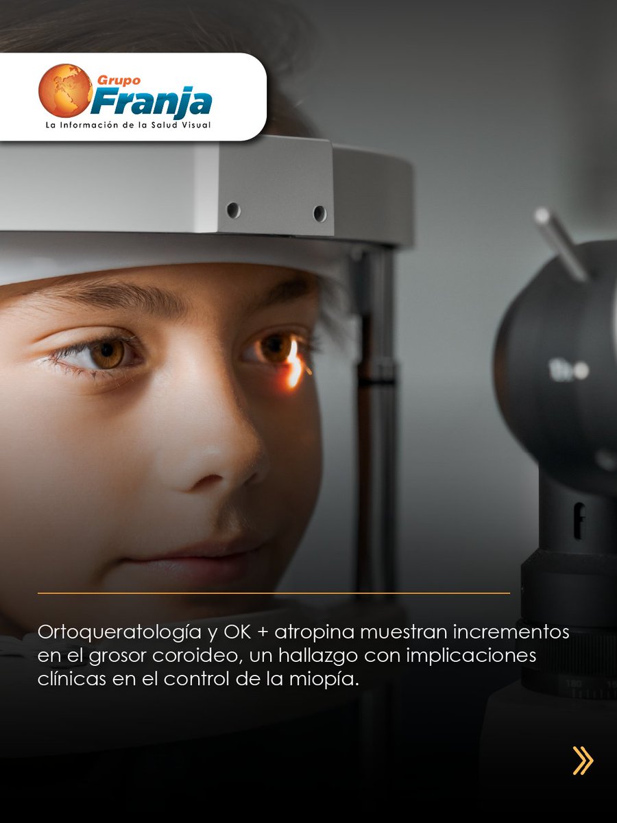 FranjaVisual's tweet image. La coroides podría ser un biomarcador del crecimiento ocular. Estudios recientes muestran que OK y OK + atropina se relacionan con aumentos en su espesor, un hallazgo clave en control de miopía.

👉🏾 f.mtr.cool/pverwixjdt 👈🏾

#NotasFranja #Lentes #SaludVisualConEstilo