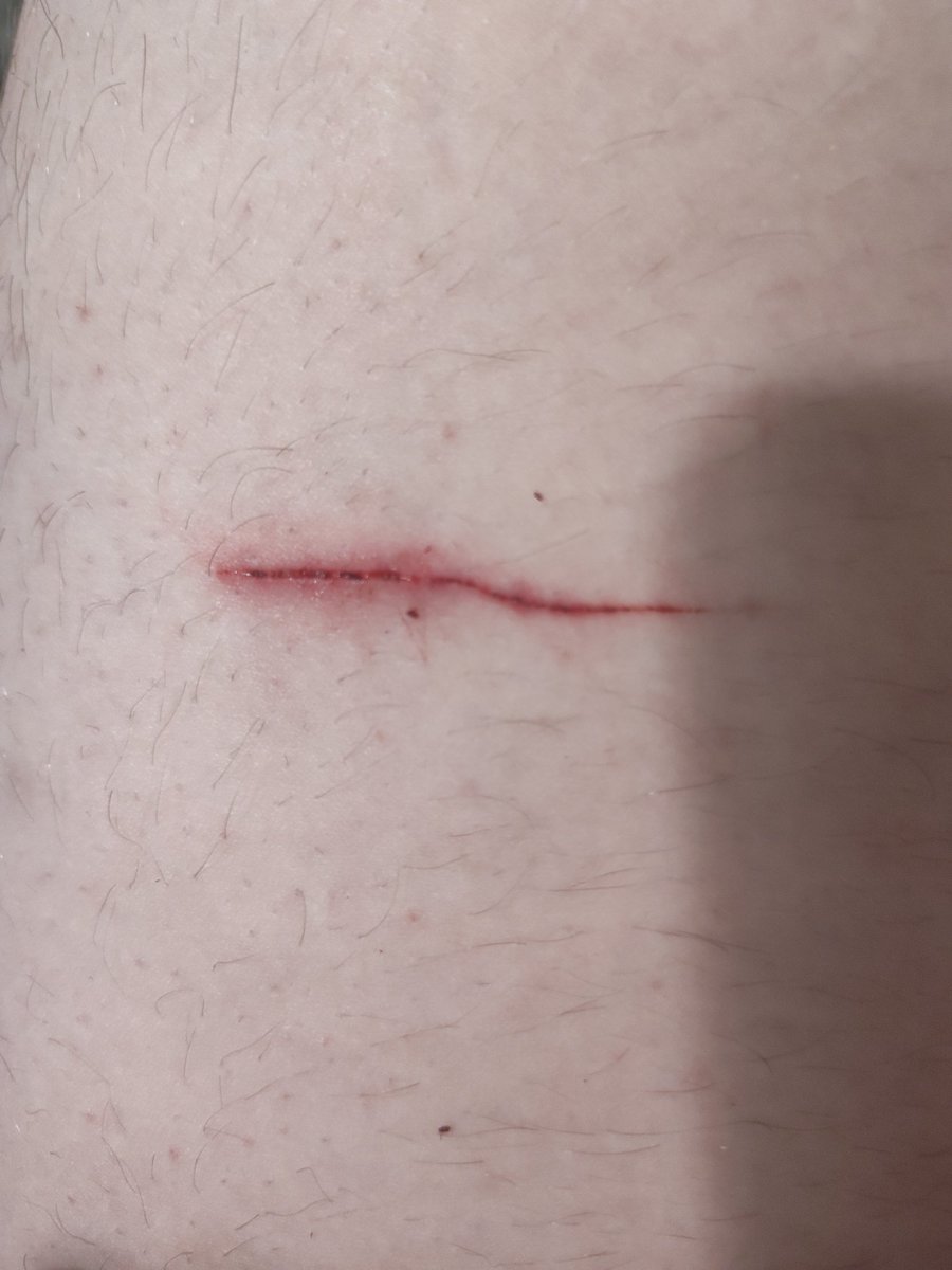 Yamazakura ✧ shtwt ⁠✧ tweet media