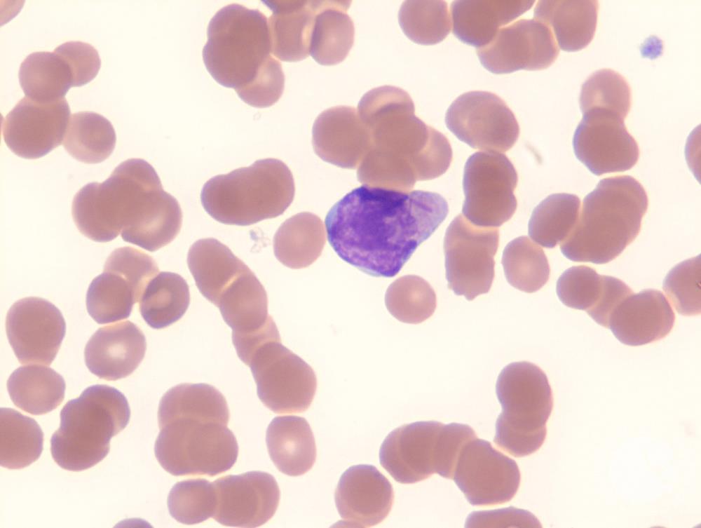 𝗡𝗶𝗵𝗮𝗿 𝗗𝗲𝘀𝗮𝗶 MD, DM tweet media