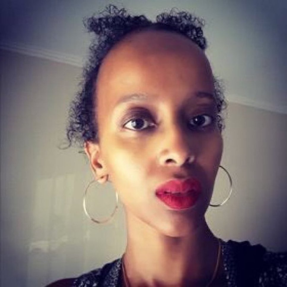 Forehead so big, the entire Somalia can fit on it.
