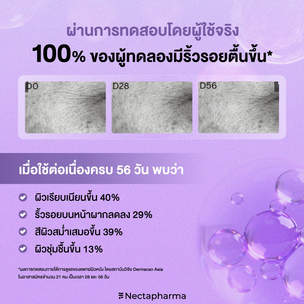 nectapharma's tweet image. ดูแลปัญหาริ้วรอยใน 28 วัน
ยืนยันด้วยผลลัพธ์ตามงานวิจัย

ตึงนอลเซรั่ม Dual Booster Retinol Serum
✨ ผิวเรียบเนียนขึ้น
✨ ริ้วรอยบนหน้าผากลดลง
✨ สีผิวสม่ำเสมอขึ้น
✨ ผิวชุ่มชื้นขึ้น

อยากลดริ้วรอยเห็นผลตามงานวิจัย จิ้มเลย! 
🛒 s.shopee.co.th/2LJWV01upl

👩‍⚕️ สนใจรับโปร สอบถามเพิ่มเติม…