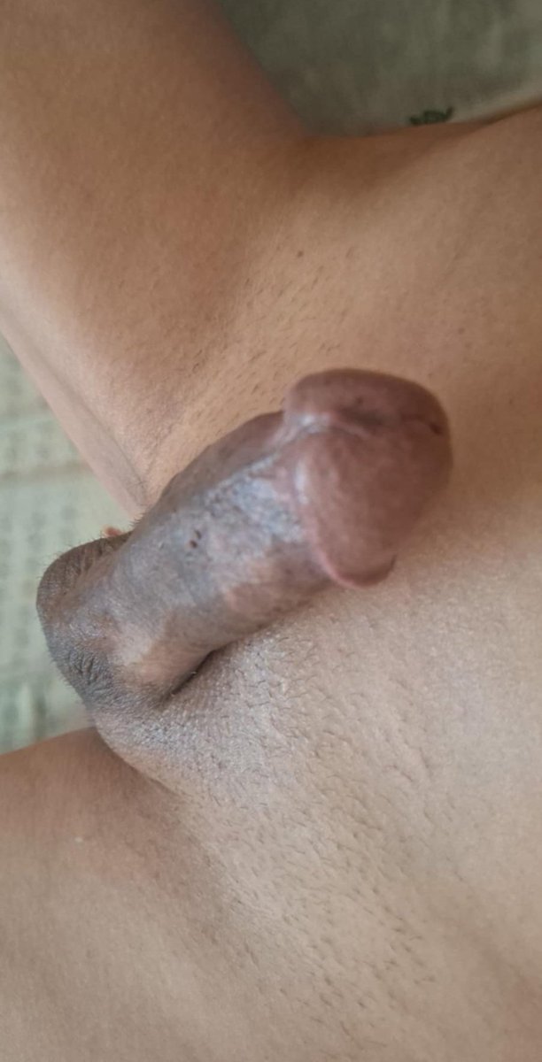 Esk merkez olgun ap p yokmu yerıolan