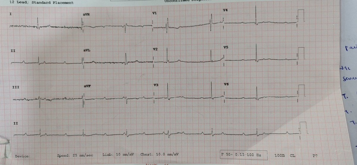 nihar_nayak2's tweet image. Findings?
Management?