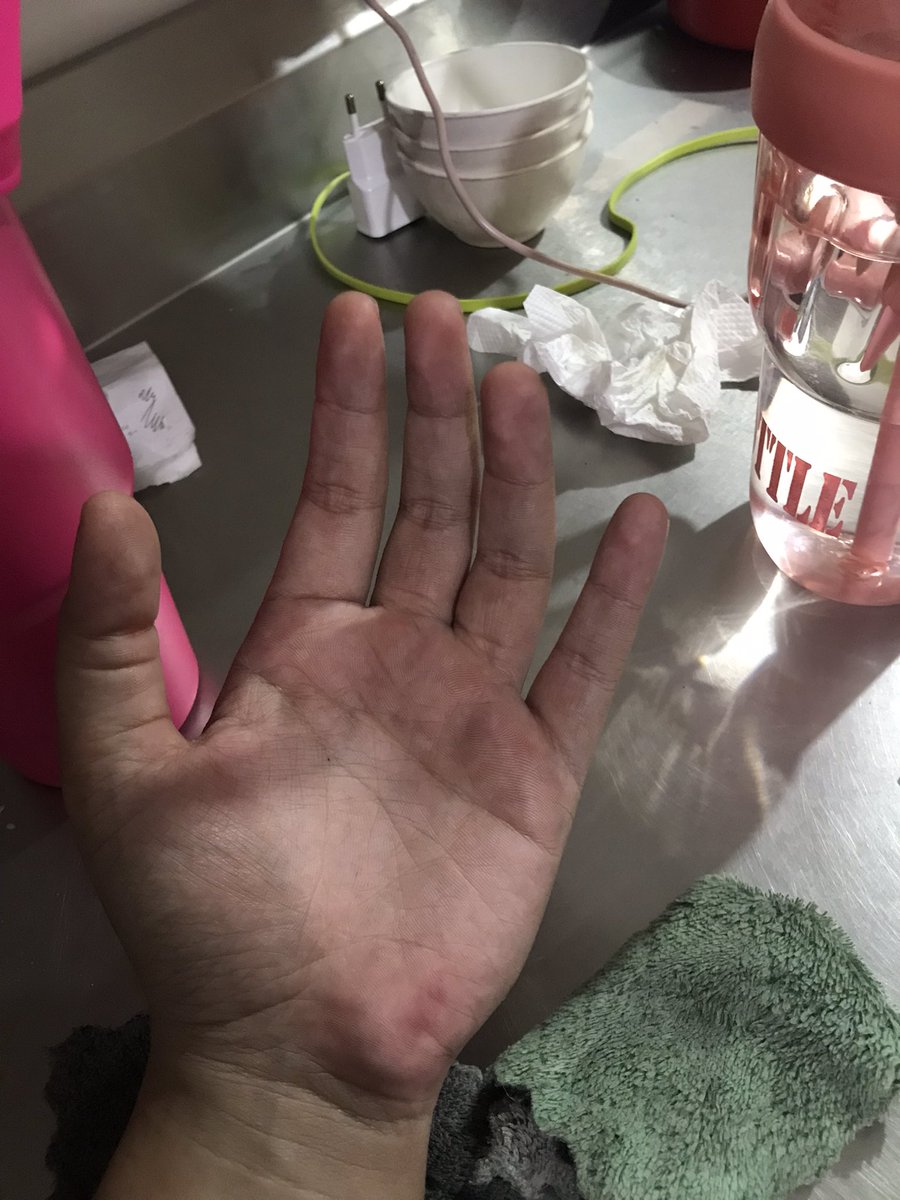 sweetfrd4's tweet photo. ini kitchen apa bengkel ya? heran bet tgn gue jd kek kang montir gini sial (fyi ini bukan kotor daki ya, tp kotor item dari abu api gitu yg udh ngendep lama dipantat panci) https://t.co/l6xKDiF8xN