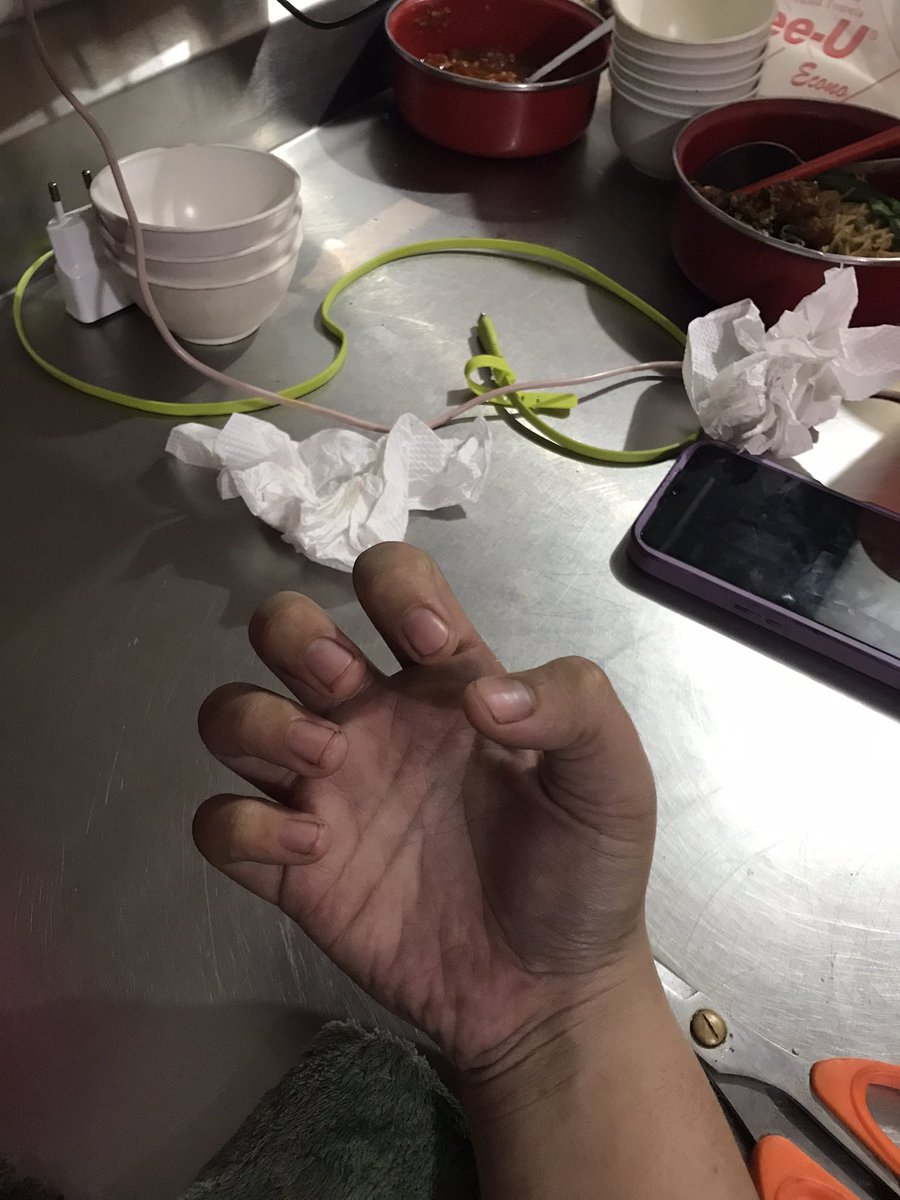 sweetfrd4's tweet photo. ini kitchen apa bengkel ya? heran bet tgn gue jd kek kang montir gini sial (fyi ini bukan kotor daki ya, tp kotor item dari abu api gitu yg udh ngendep lama dipantat panci) https://t.co/l6xKDiF8xN