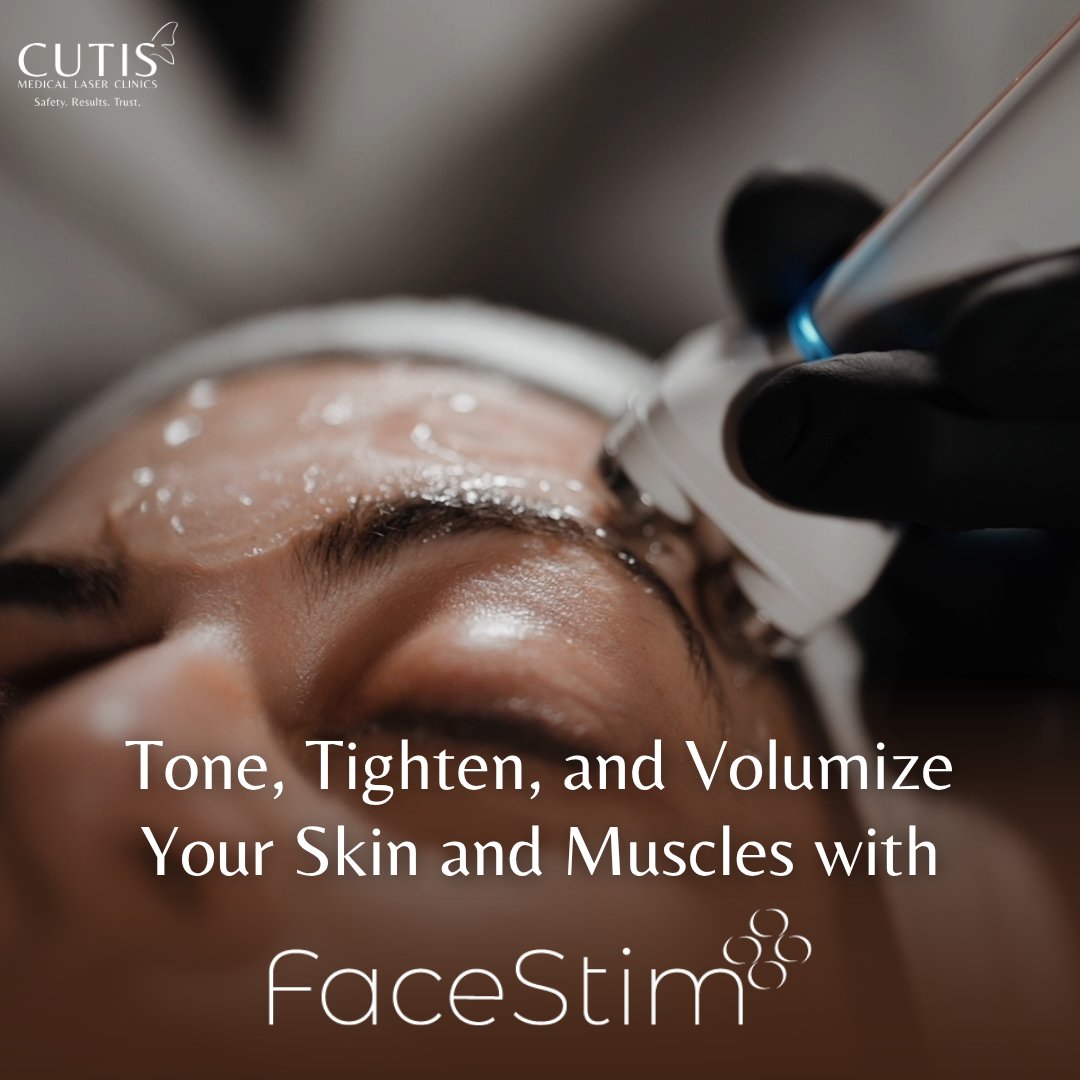 cutislaser's tweet image. Achieve natural-looking lift and definition with FaceStim. Combining bipolar RF with targeted muscle stimulation, this “facial workout” tones underlying muscles, tightens the skin, and restores youthful contours.

Benefits:
• Elevated brows and refreshed upper face
• Firmer…