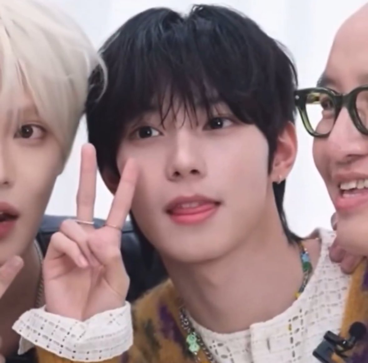 his bunny teeth 😭😭😭😭😭😭