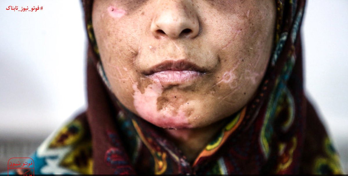 مرضیه محبی tweet media