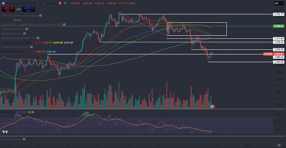 teorexinvesting's tweet image. $ETH following Bitcoin bounce, regained 2880 and is currently backtesting it. Would love it to hold and get back above 3k again, signaling a stronger bounce than many expect, and a possible swift recovery. Most are not prepared for a V shaped recovery, and liquidations are havily…