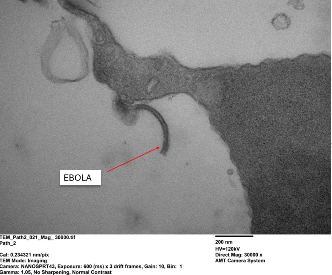 Keep up lad. We've already done Ebola.