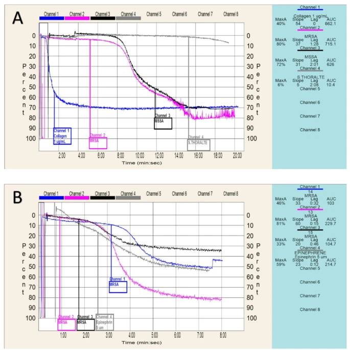 Thrombosis_J's tweet image. 🚨Article Alert🚨

Enhanced platelets aggregation and coagulation of methicillin-resistant Staphylococcus aureus compared to methicillin-sensitive Staphylococcus aureus 🔬
#OpenAccess #StaphylococcusAureus #ThrombosisResearch

Read the article: doi.org/10.1186/s12959…