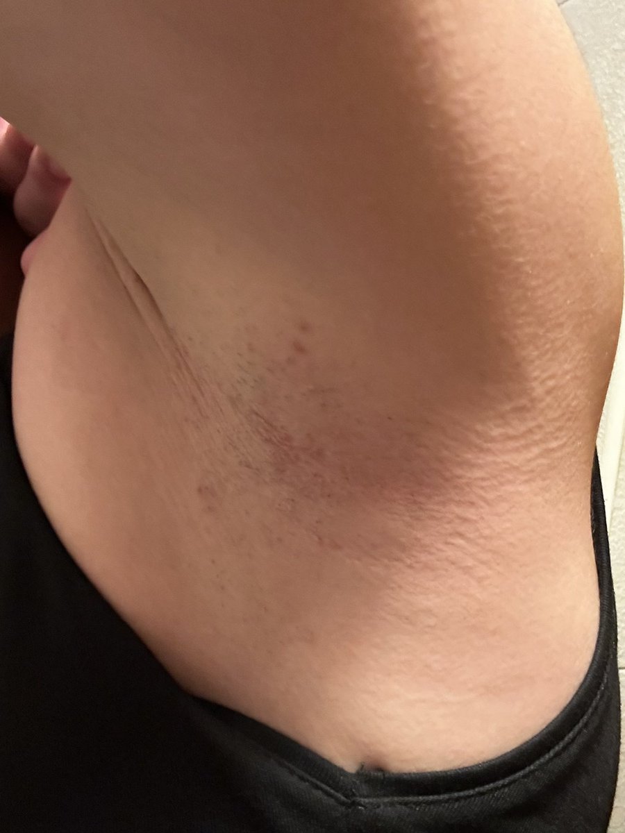 Armpits_Buttons's tweet photo. Extra stinky today, with a hint of her sweet perfume👅 https://t.co/r7wa6JGwAo