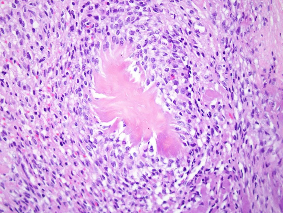 Kalyani Bambal tweet media