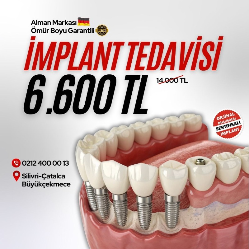 YucelerHealthAS's tweet photo. Yılsonu Kampanyası
Alman Malı İmplant 14.000₺ yerine 6.600₺
Ücretsiz Muayene ve 3D Tomografi