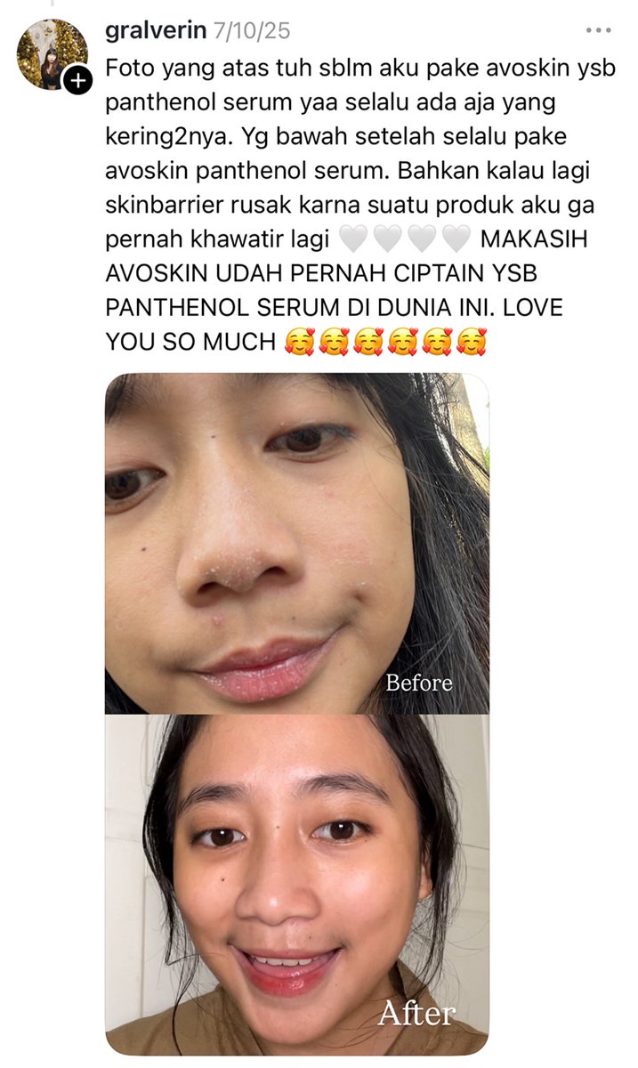 avoskinbeauty's tweet photo. Yang kulitnya kering kayak gini, sampe rasanya perih, MERAPAT!😩
1 Serum ini bisa bikin kulit kamu jadi lebih sehat, karena skin barrier terawat💓
Udah cobain atau masih jadi wishlist?👀
#FromBasictoAdvanced https://t.co/jmo2J3ZkM7
