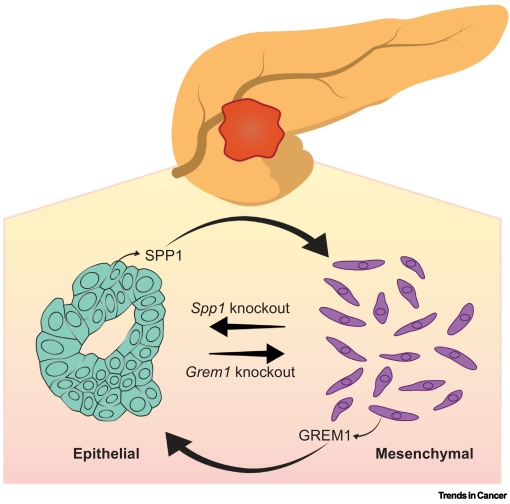 Aiims1742's tweet photo. New @trendscancer commentary:
Tumor-intrinsic dichotomy shapes cellular heterogeneity in #PancreaticCancer 
https://t.co/cdZzPTzgcZ
Original paper:
SPP1 is required for maintaining mesenchymal cell fate in pancreatic cancer
https://t.co/zpwlhNvIV6 https://t.co/rNxO9yCzsM