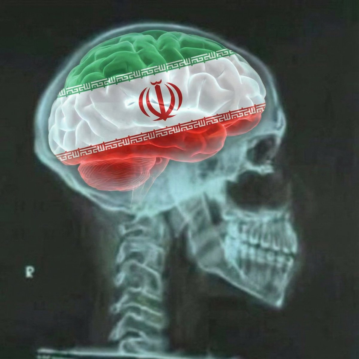 صورة أشعة لرأس #نعيم_قاسم