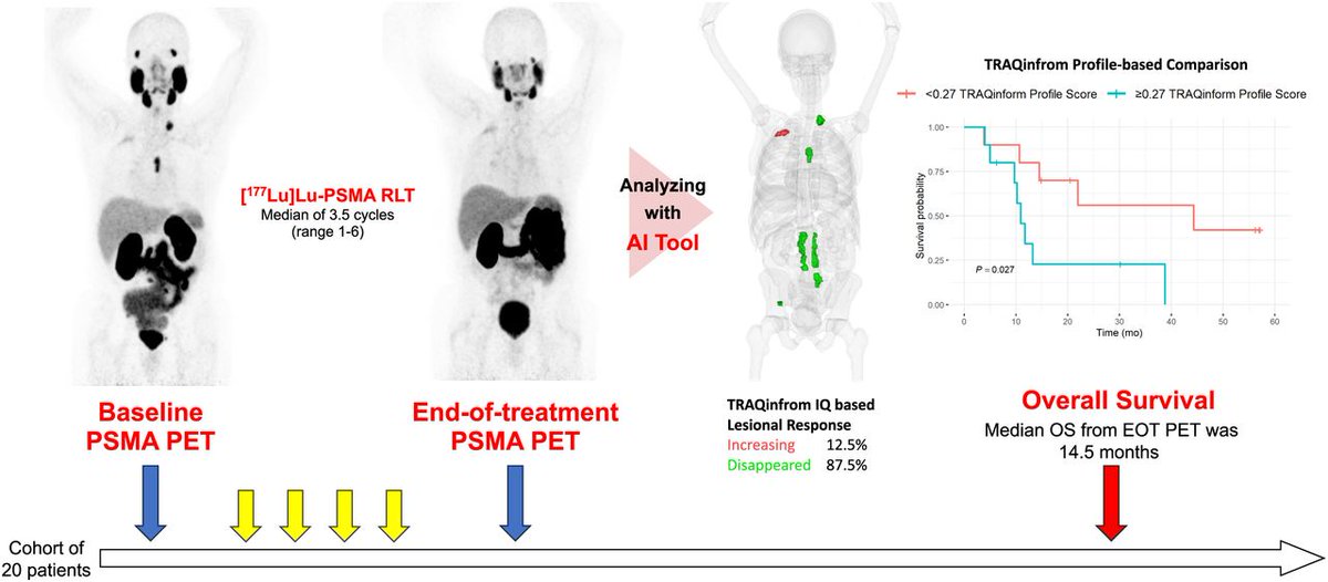 JournalofNucMed's tweet image. AI–assisted lesion-tracking analysis of PSMA PET is prognostic for overall survival in patients with mCRPC undergoing PSMA radiopharmaceutical therapy. ow.ly/JOvo50XqIMQ 

#NuclearMedicine #RPTherapy #ProstateCancer @VMurthymed @CalaisJeremie @DrAGafita