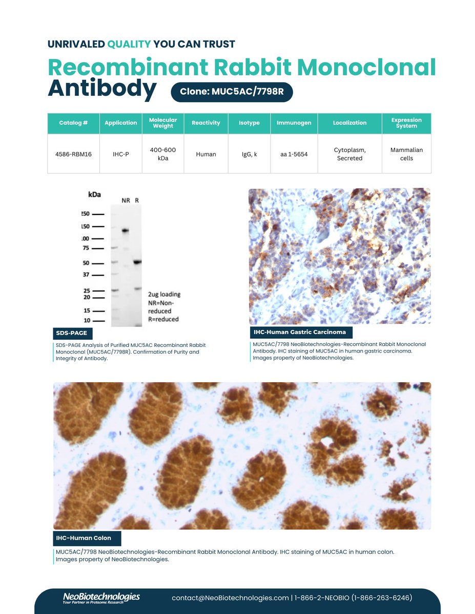 neobio_mabs's tweet image. Explore NeoBiotechnologies’ MUC5AC monoclonal antibodies—key tools for studying gastric cancer, mucin biology, and mucosal immunity. High specificity and validated performance worldwide. 

#MUC5AC #ResearchTools #GastricCancer