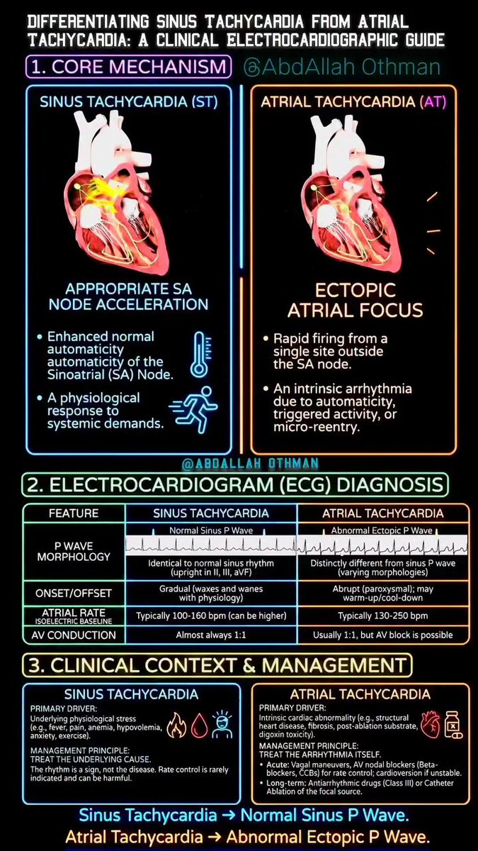 Differentiating Sinus Tachycardia vs. Atrial Tachycardia: A Quick Guide ⚡️❤️
facebook.com/share/r/1AEReR…
#Cardiology #ECG #Arrhythmia #SinusTach #AtrialTachycardia #MedEd #CardioTwitter #HeartRhythm
