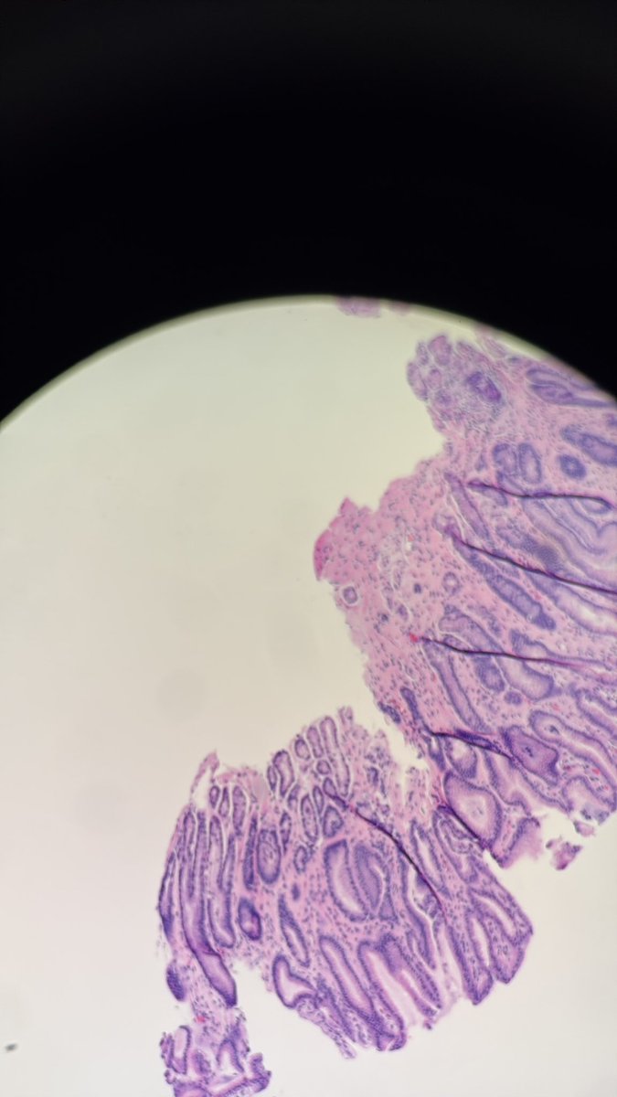 PathServerUS's tweet image. Starting the day with some GI biopsies!

GM GM!