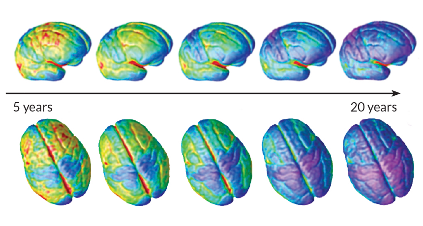 SammyRArmstrong's tweet image. Here’s what really happens to your brain as you get older, from birth to late adulthood: