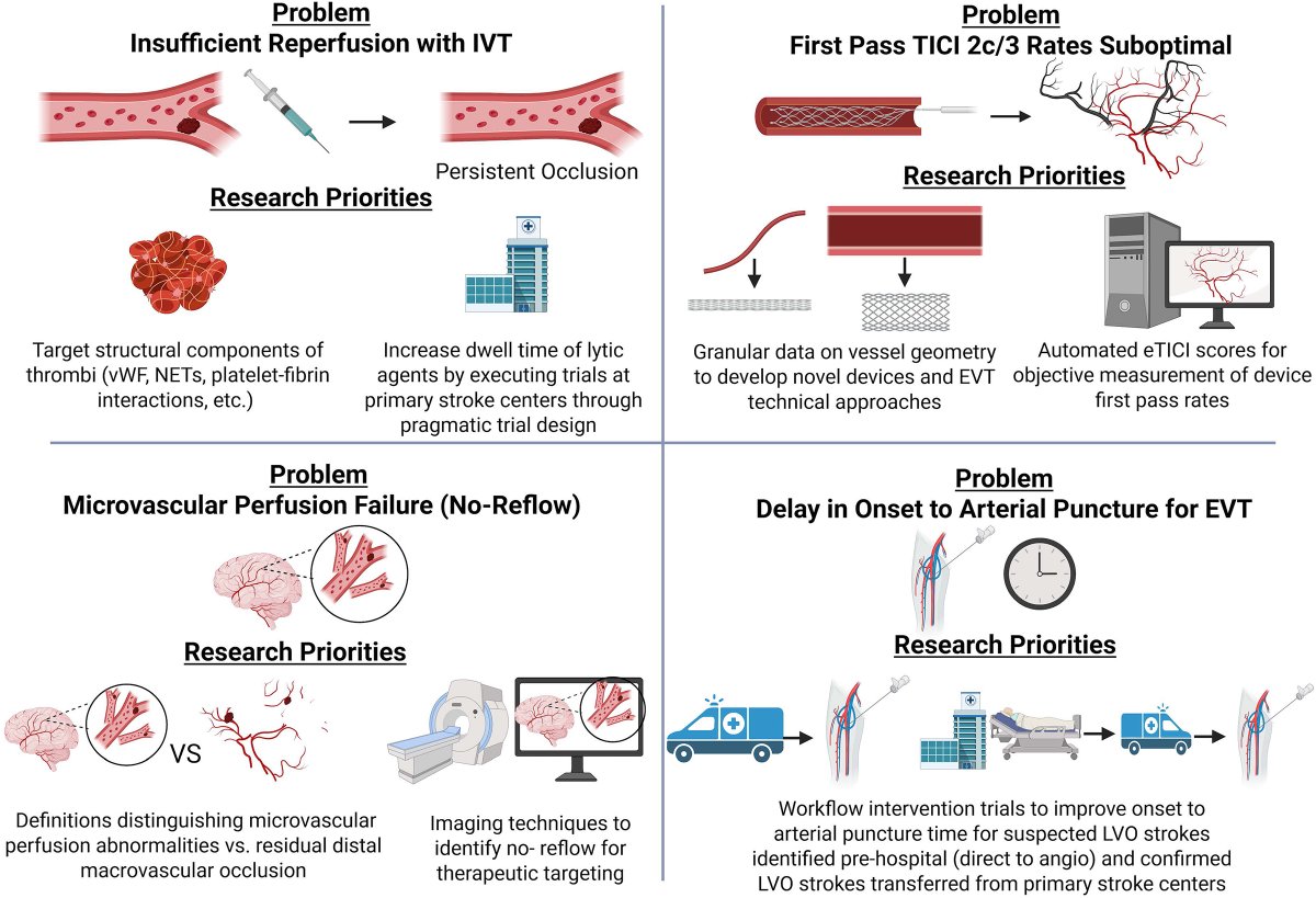 StrokeAHA_ASA's tweet image. This topical review by Campbell et al. discusses the optimization of #stroke reperfusion trials, key imaging research priorities, and improved definitions for macro vs microvascular reperfusion. ahajournals.org/doi/full/10.11…

@GeorgeHarston @PoojaKhatriMD @FishingNeurons @NguyenThanhMD