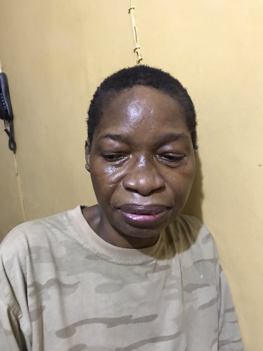 allaboutwura's tweet image. Day 41 of seeking financial help for my sick mom, who was diagnosed with ALS, a condition that causes loss of walking, proper hand use, and speech. Currently, there is no cure, but it can be managed.

2343616614 Uba Wuraola Oyenola

8140596483 Opay Adesewa Oyenola