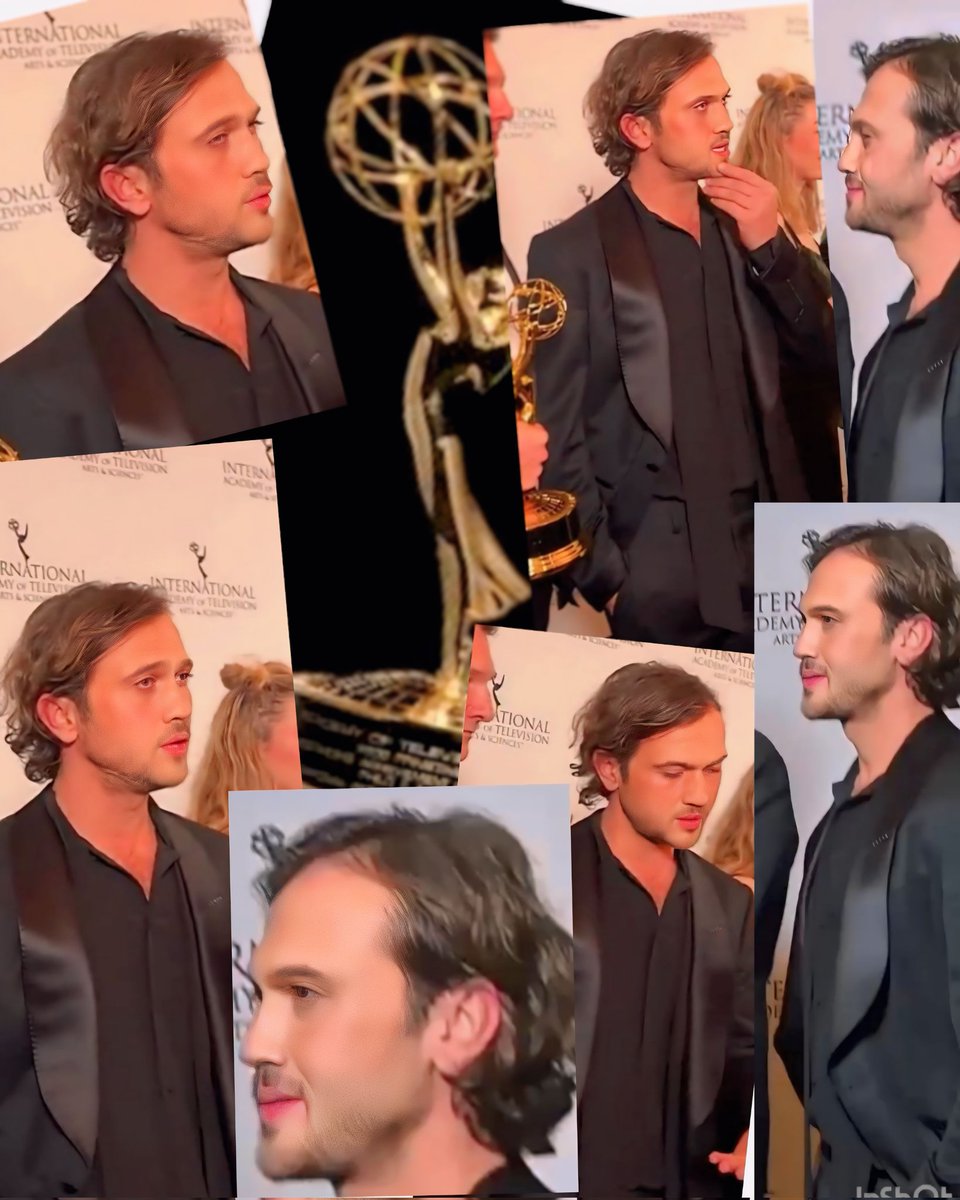 After losing one of the people you love most, breaking your leg because of it, and receiving criticism for it, you have the right to receive all the awards.

<a href="/Aras_B_iynemli/">Aras Bulut İYNEMLİ</a> 
#Arasbulutiynemli