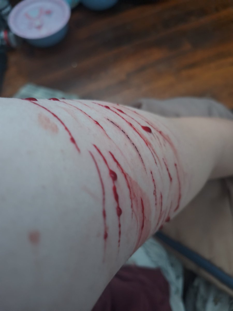 Yamazakura ✧ shtwt ⁠✧ tweet media