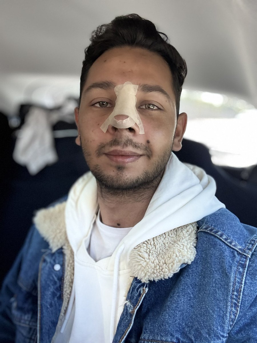 Musa648343Musa's tweet photo. Şükür tamponlarım çıktı eahat bi nefes alabilirim🙄🙏
#keşfet #bodrum https://t.co/TItCH4A2AO