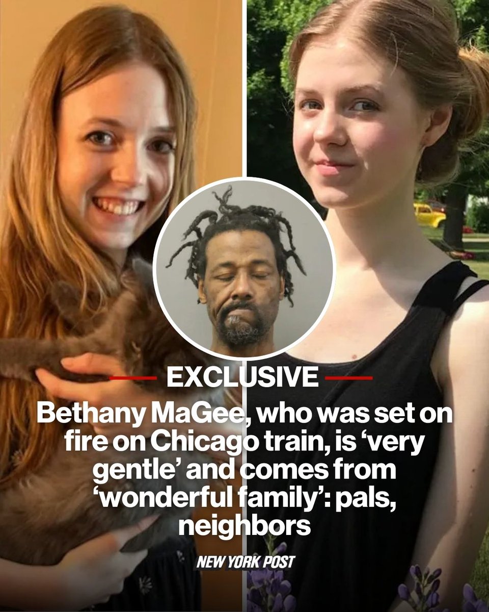 Her family is now reeling as she fights for life, covered in gruesome burns.