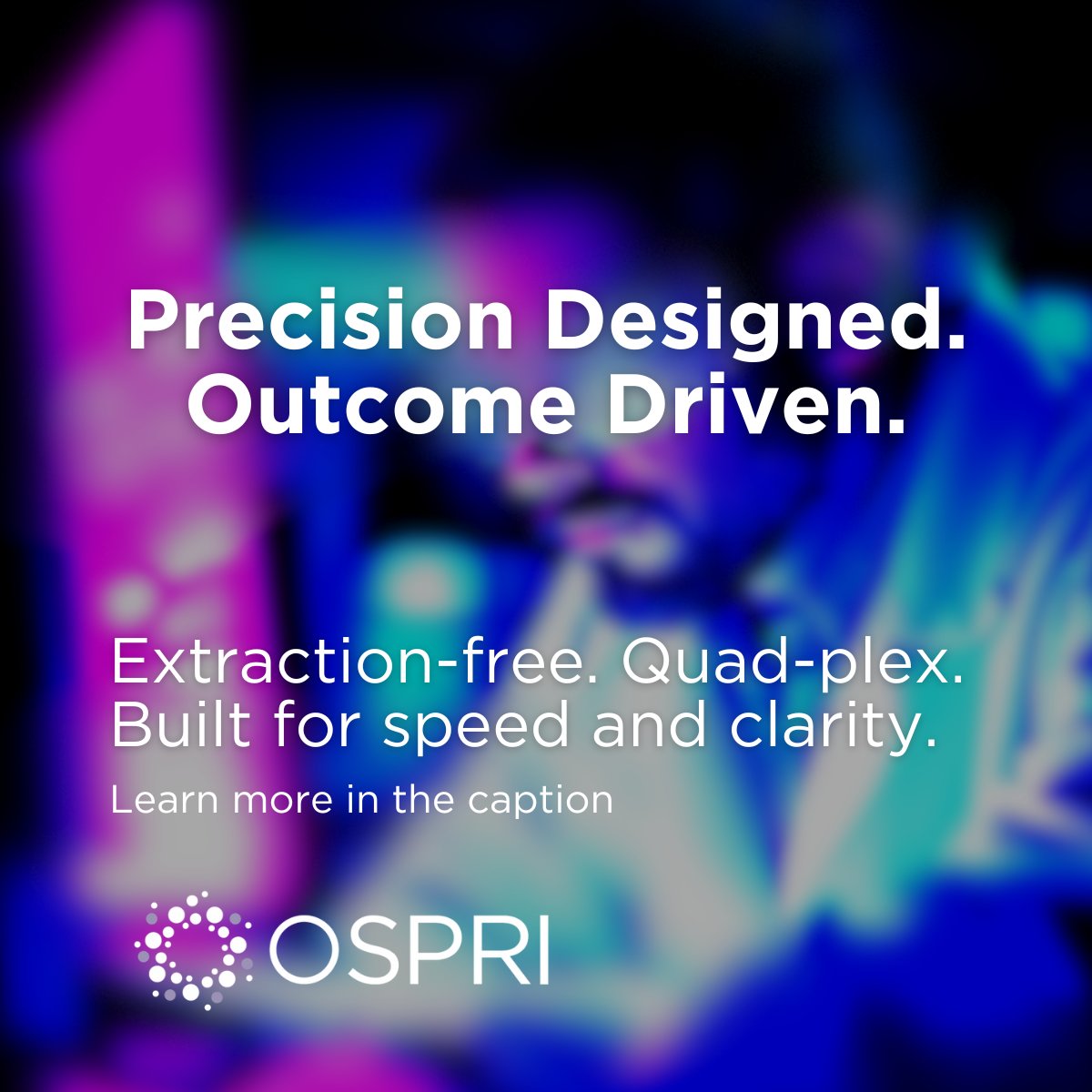 OSPRIBioPath's tweet image. Fewer steps, more clarity.
Our extraction-free + quad-plex workflow helps teams move fast and stay accurate.
Explore the full assay menu 👉 ospribio.com/assays
#InnovationInAction #LabEfficiency