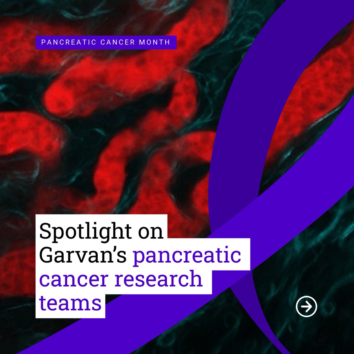 GarvanInstitute's tweet image. This Pancreatic Cancer Awareness Month: our labs bring live imaging, tumour environment expertise and resistance insights to the same urgent challenge. Their work informs each other, building understanding together. 💜
Discover our research: ow.ly/yr1l50XxiSA